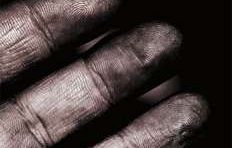 دراسة حديثة : التهاب الجلد قد يخفي بصمة اليد